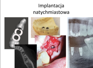 Przypadki kliniczne 