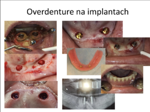 Przypadki kliniczne 